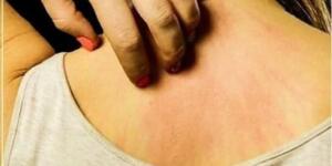 K-a’n ser Olduğunu İlk Gün Anla! İş’te Belirtileri…