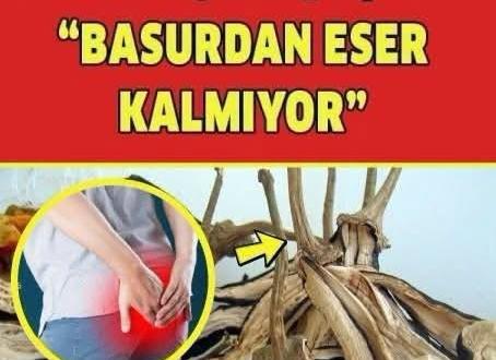 Basurun kolay t’edavisi!